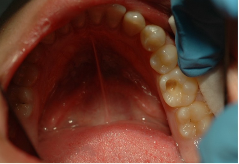 Slide 2