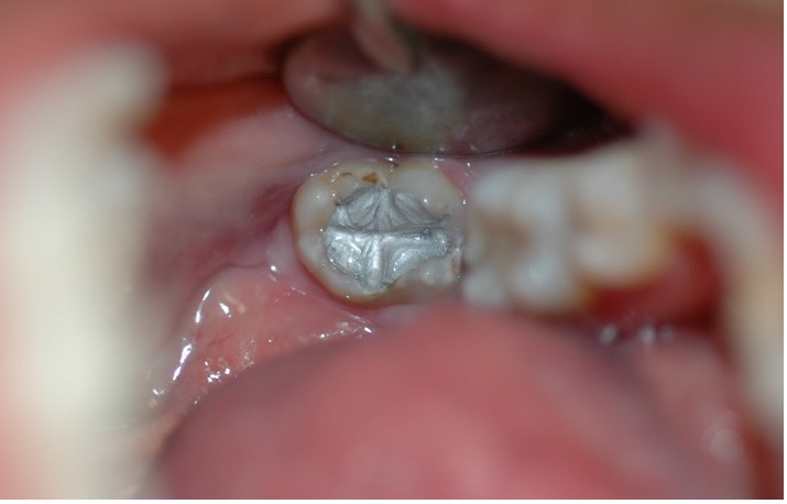 Slide 1