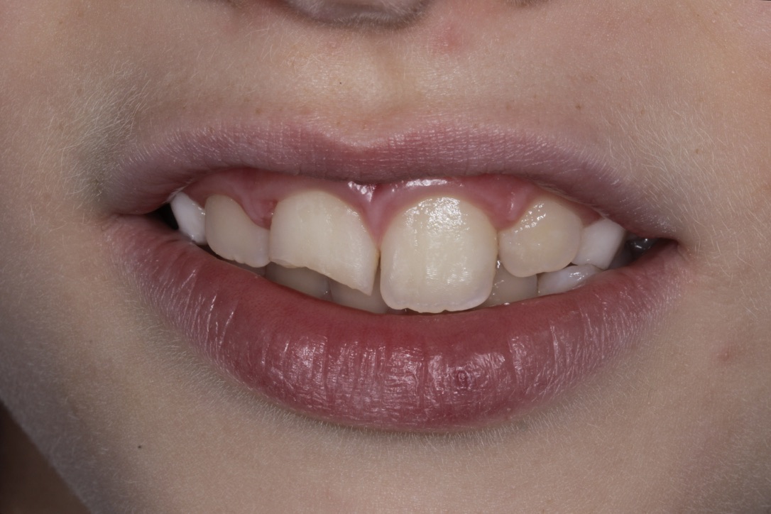 Slide 2