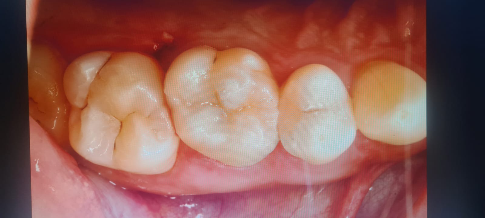 Slide 2