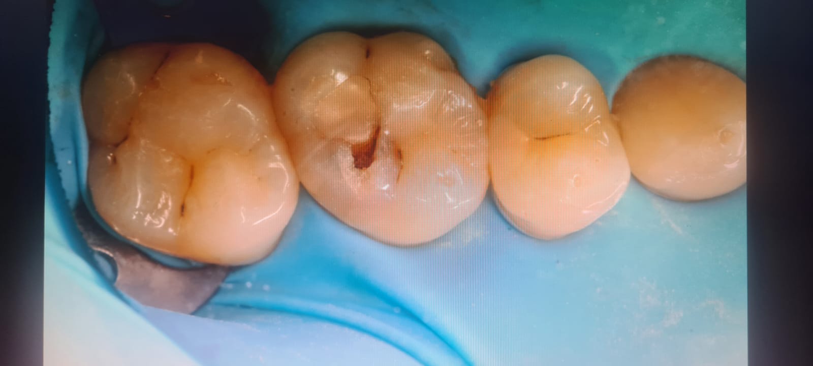Slide 1