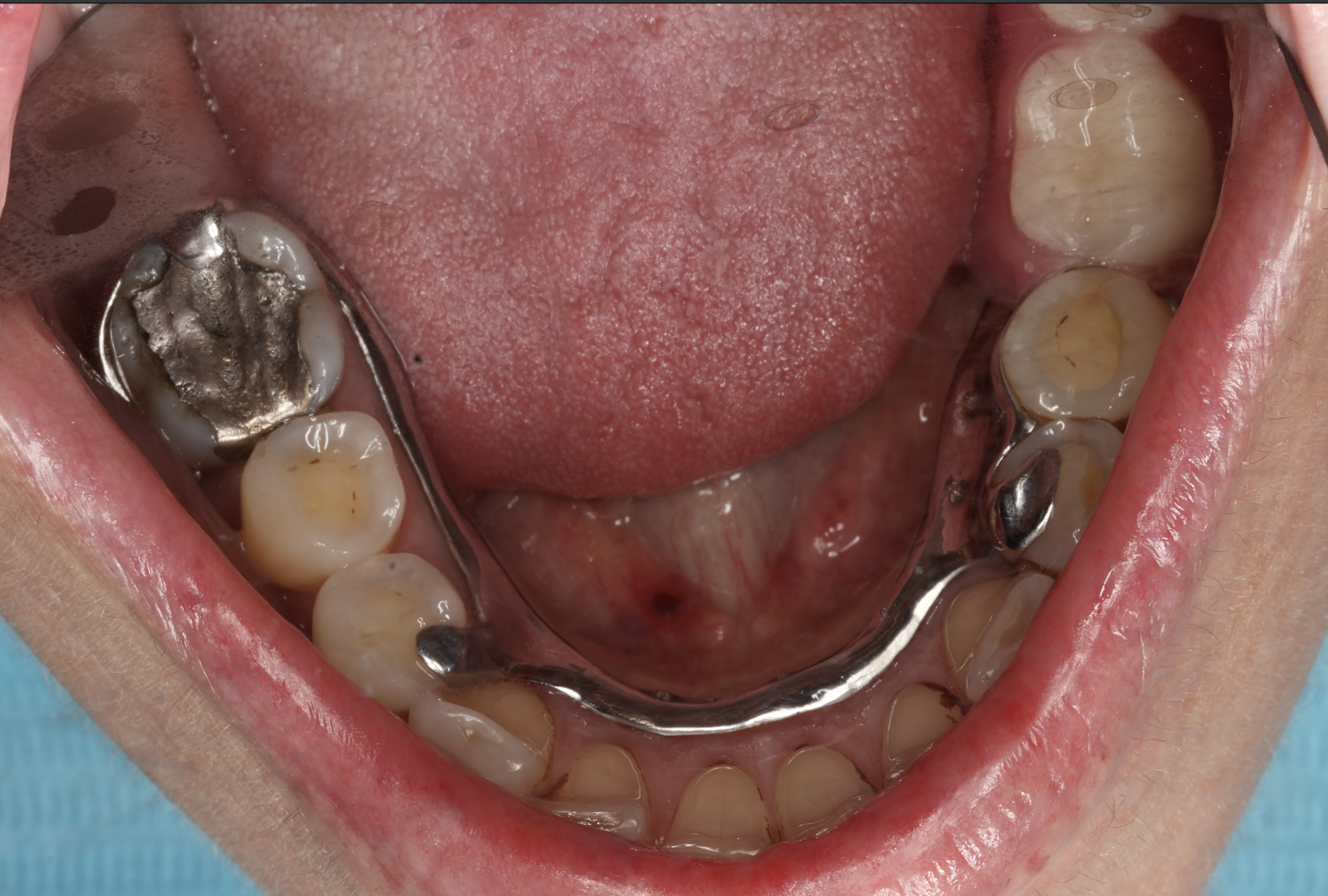 Slide 3