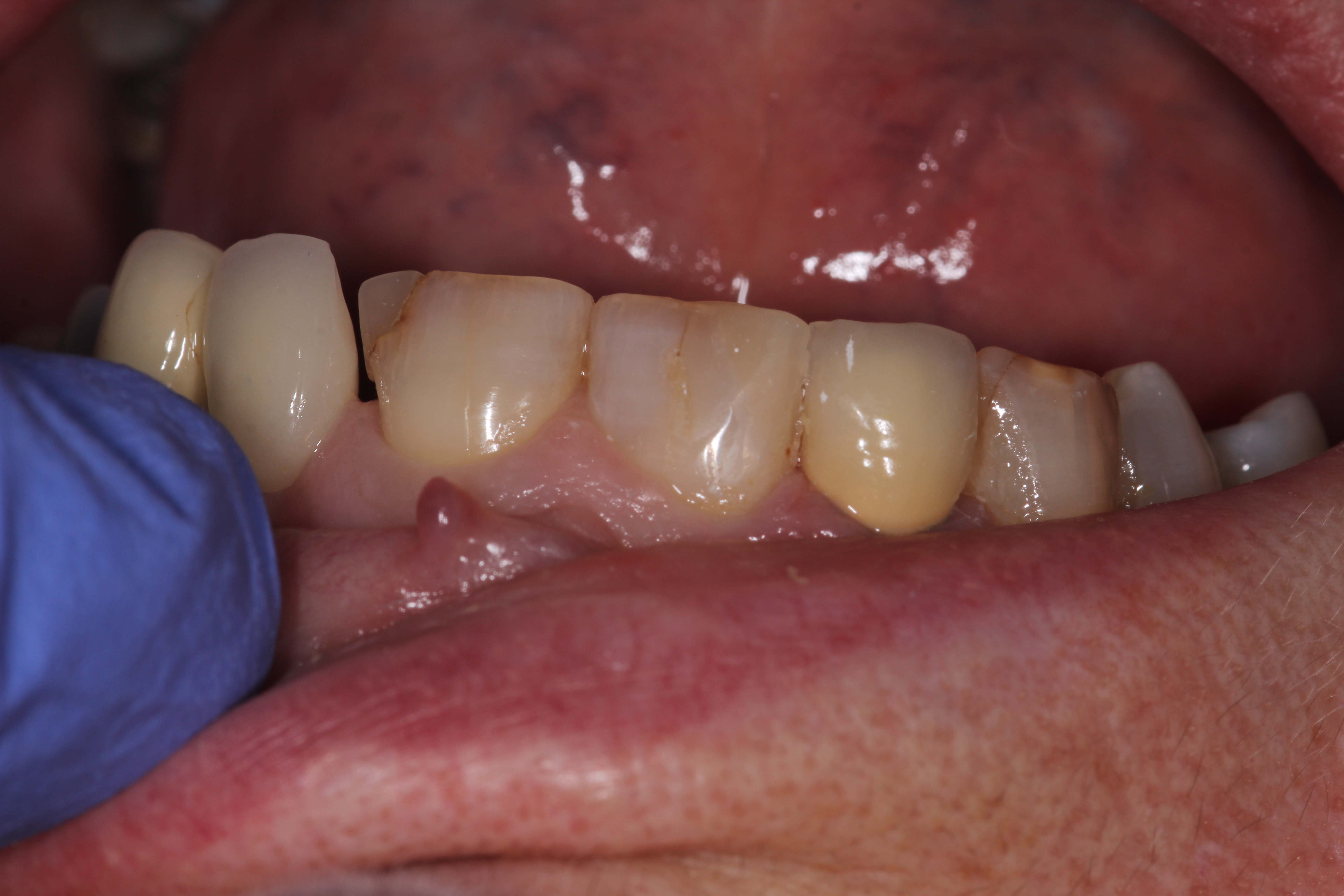 Slide 2