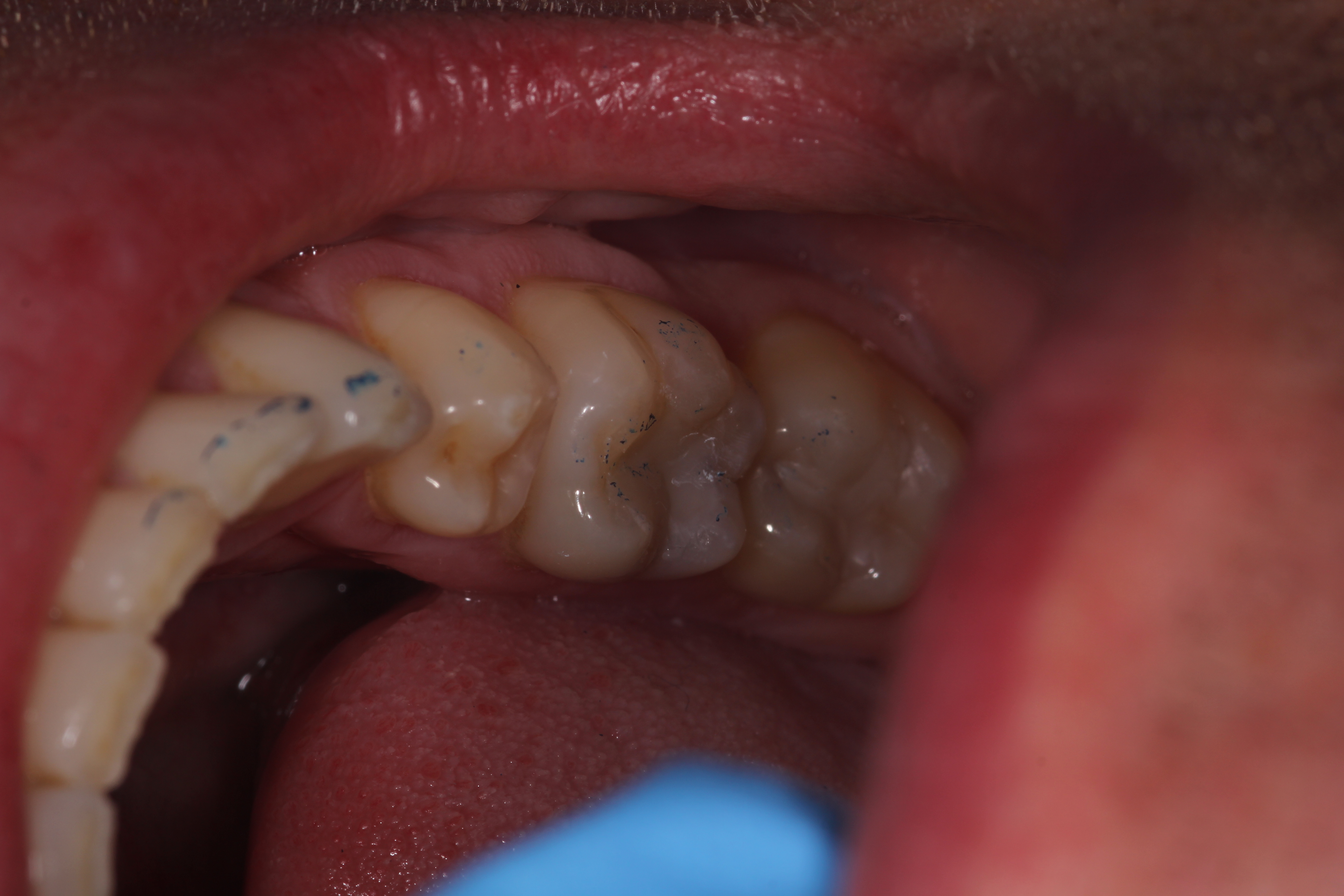 Slide 2