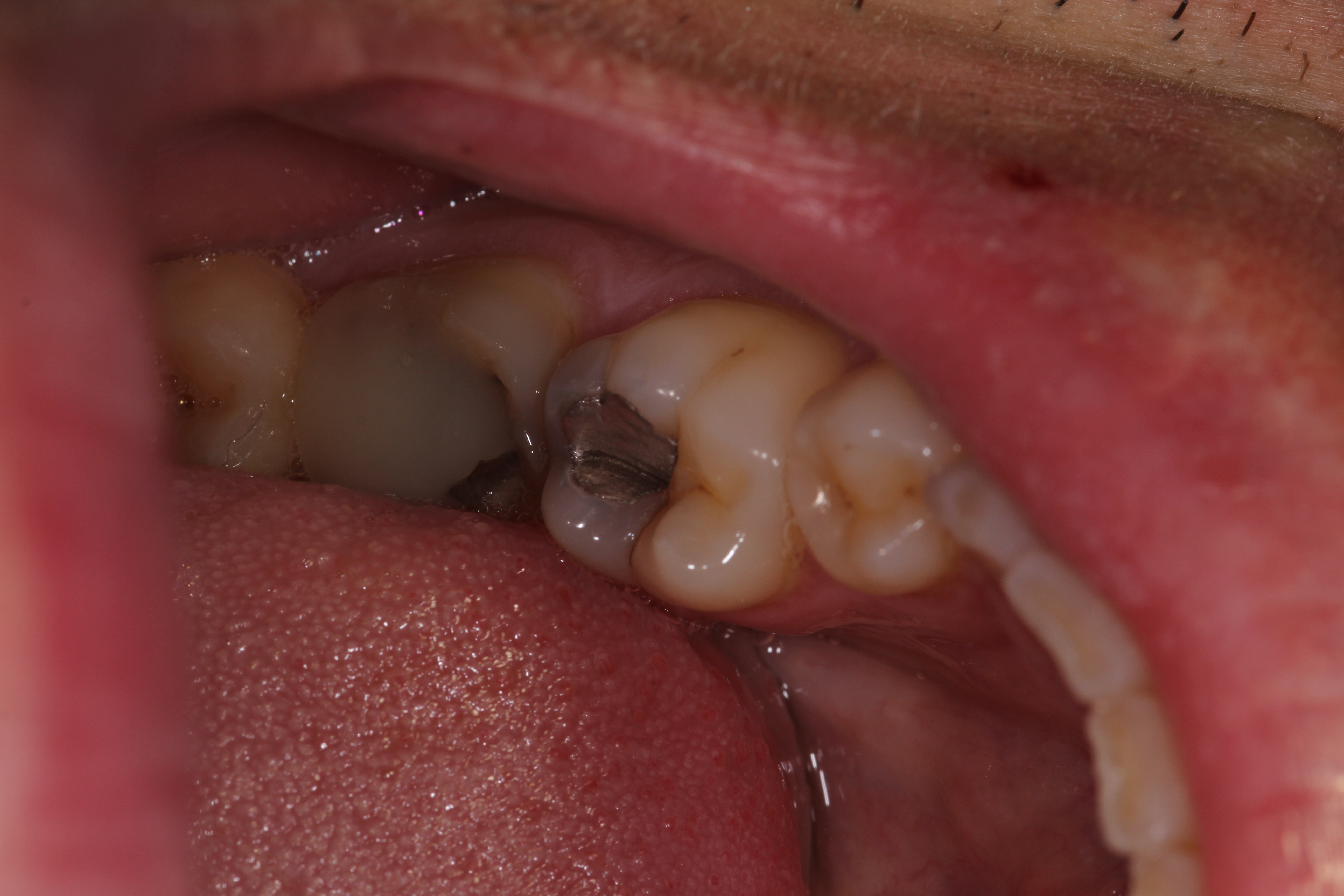 Slide 3