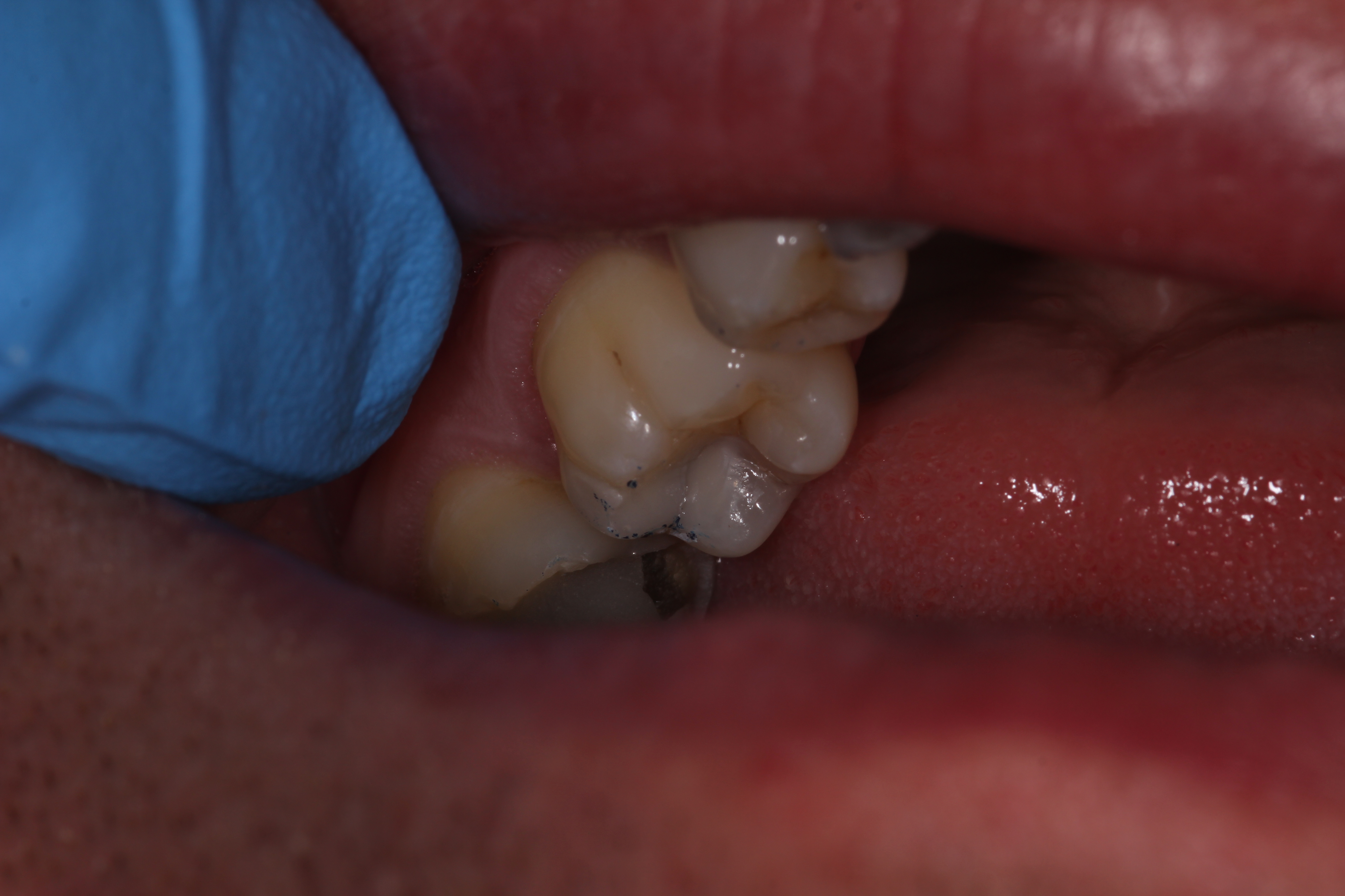 Slide 4