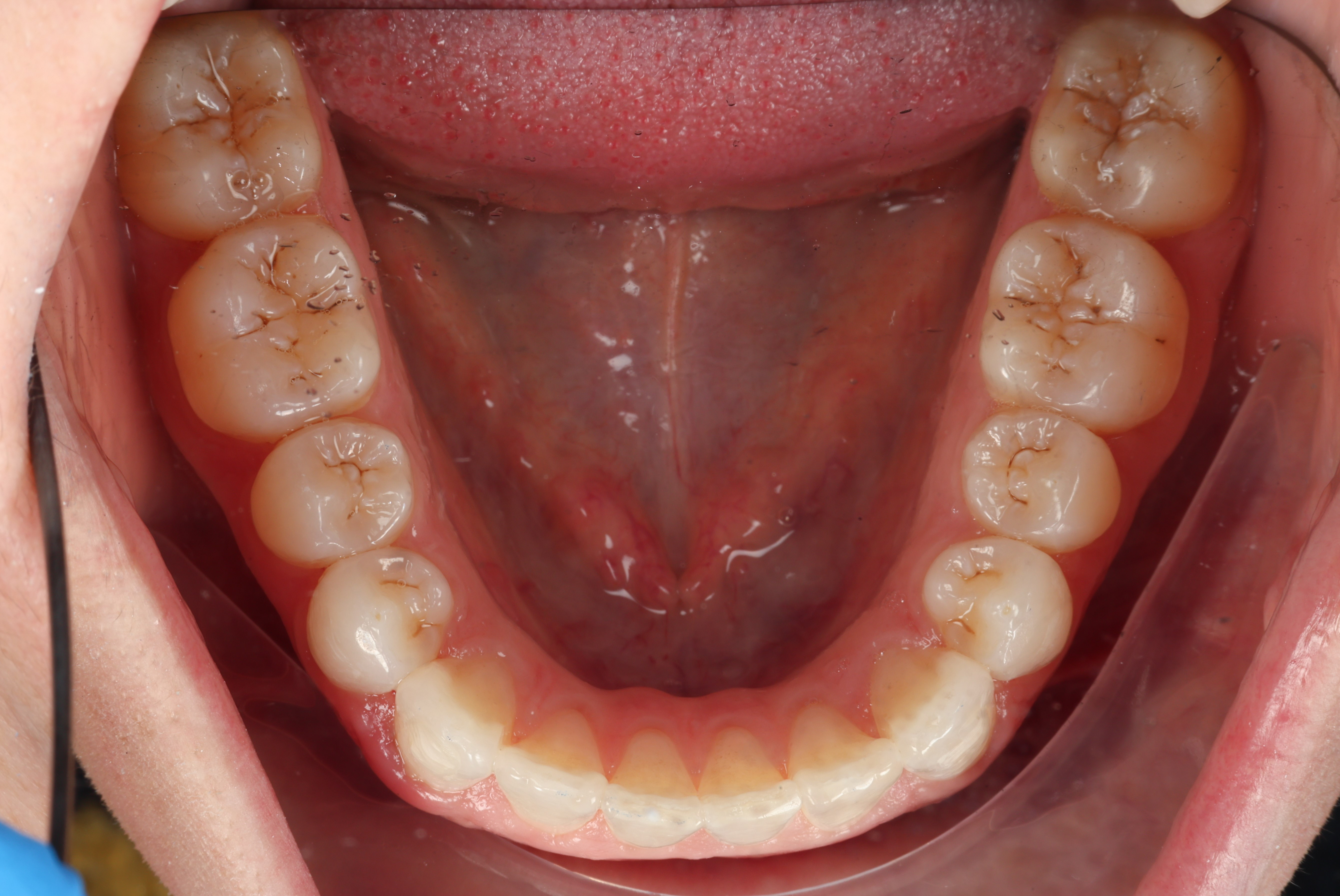 Slide 6