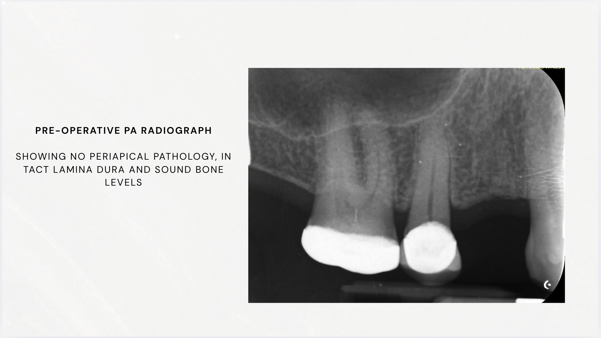 Slide 2