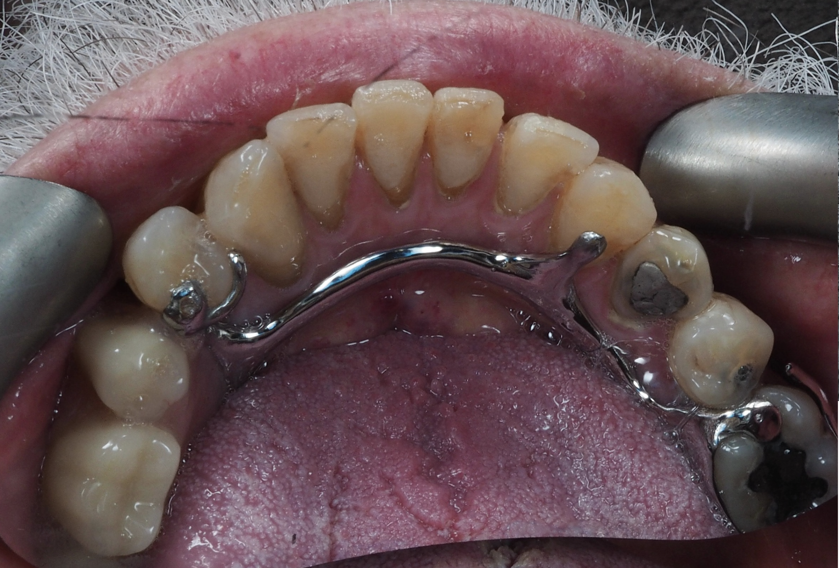 Slide 3