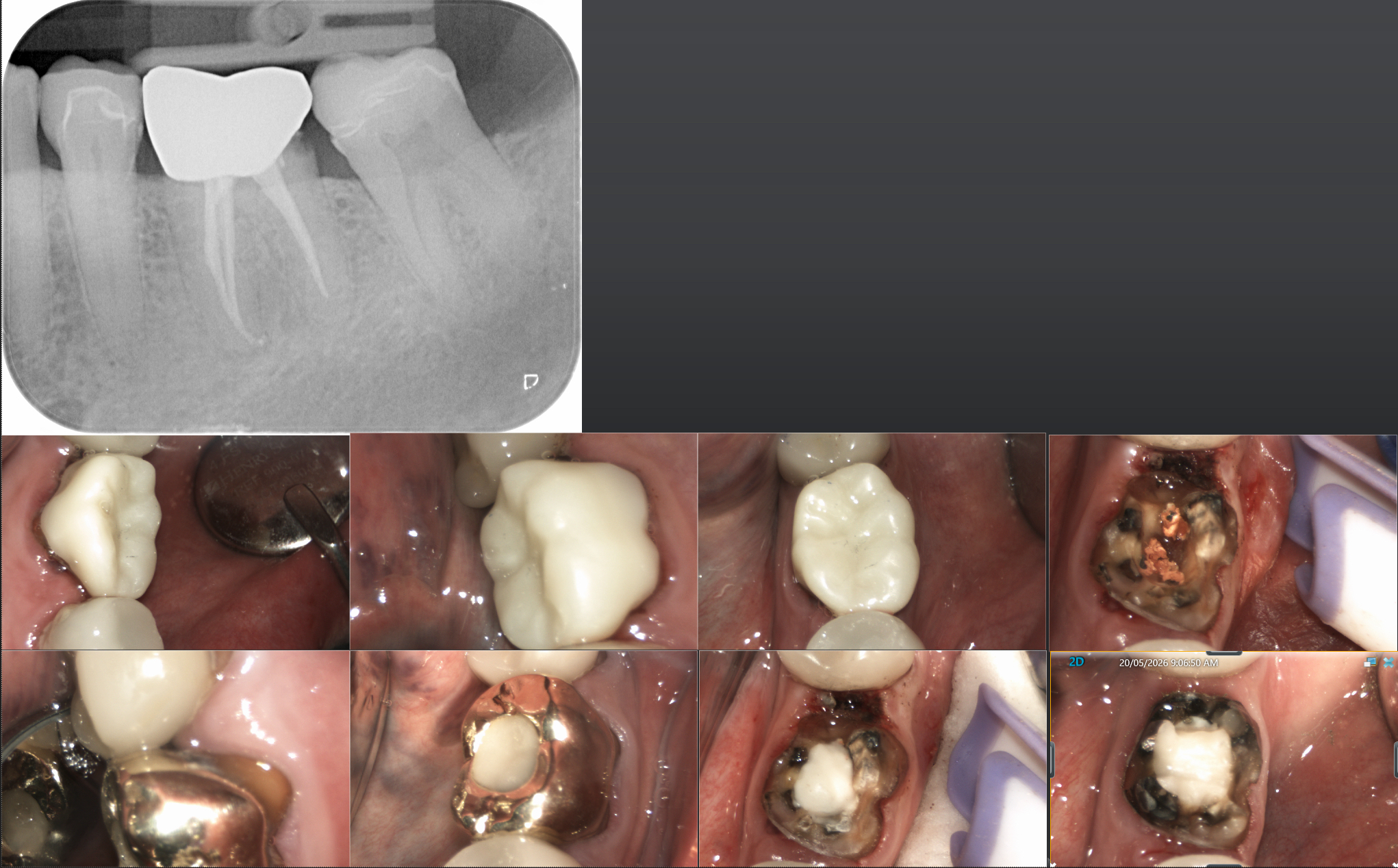 Slide 1
