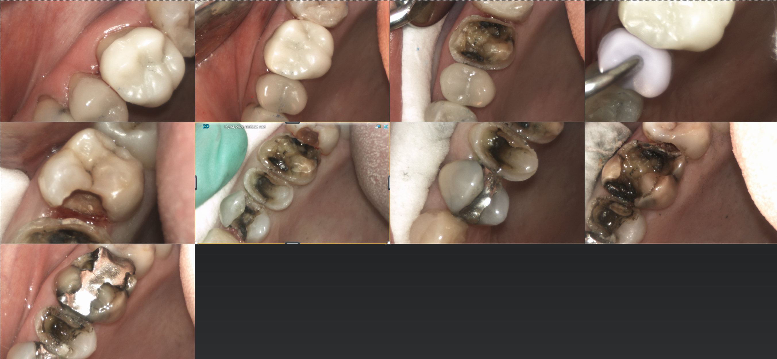 Slide 1