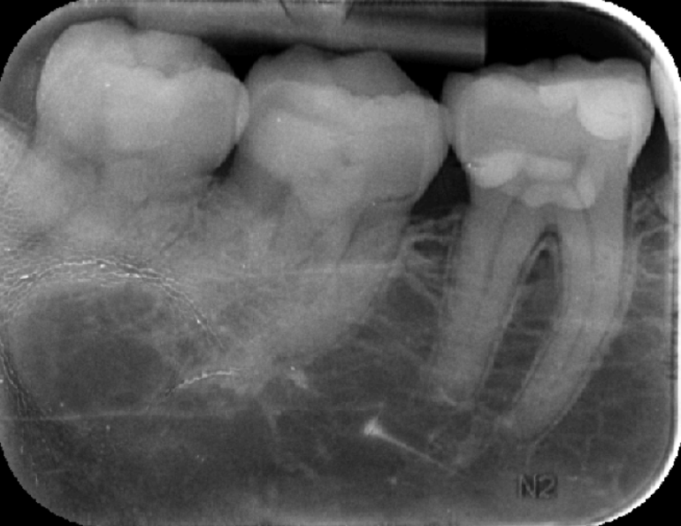 Slide 2