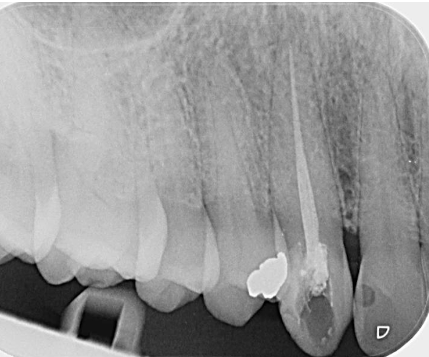 Slide 2