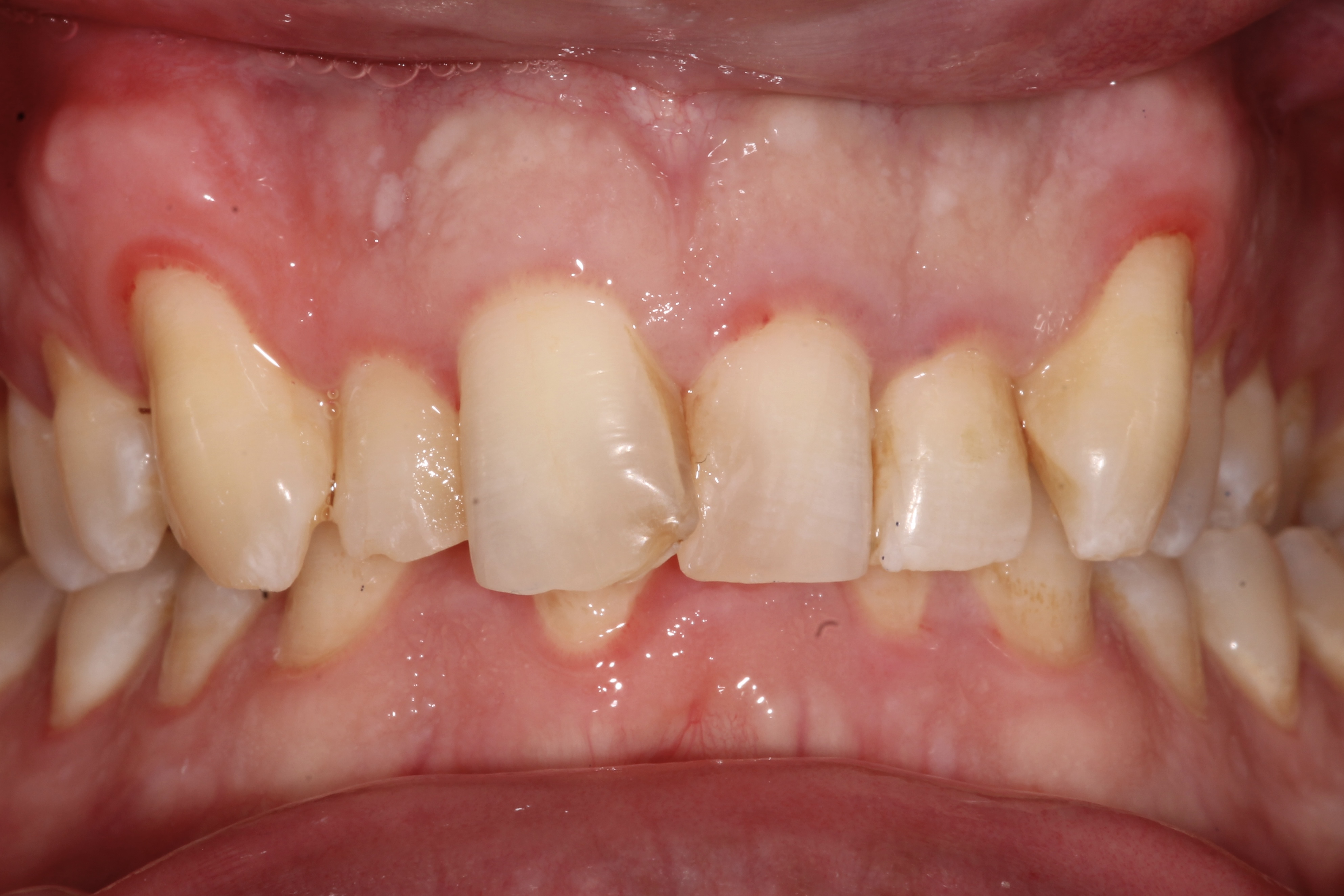 Slide 2