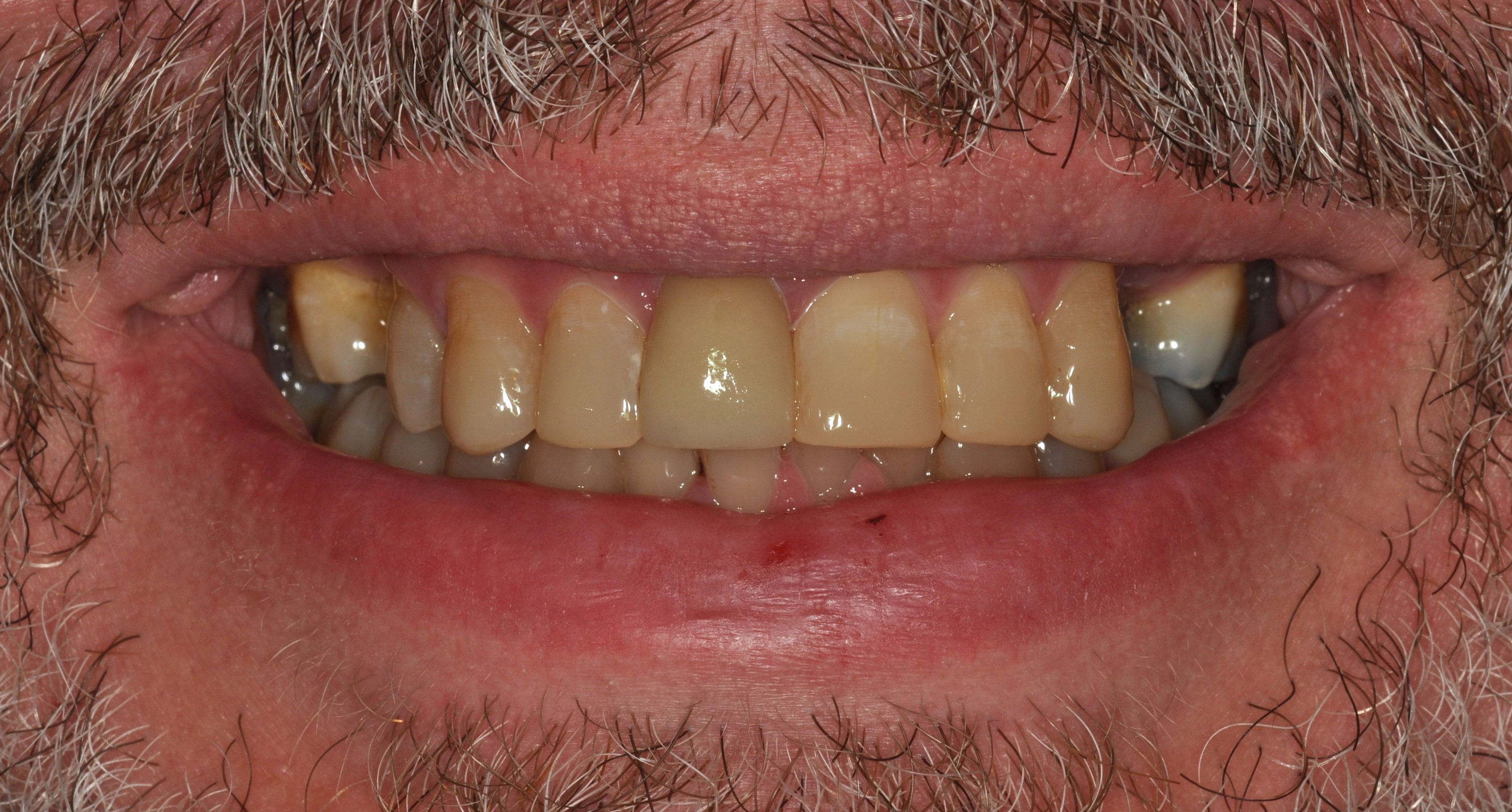 Slide 2