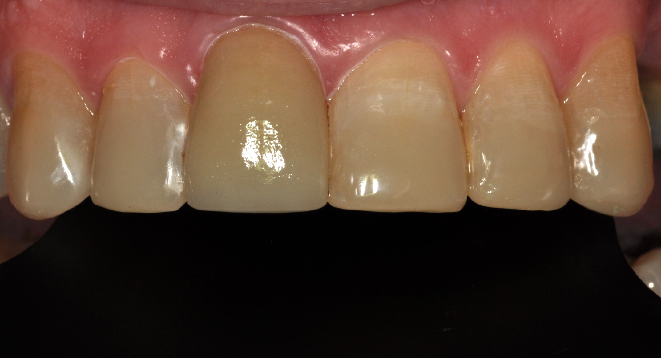 Slide 2