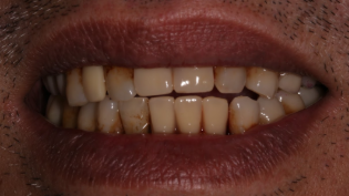 Slide 2
