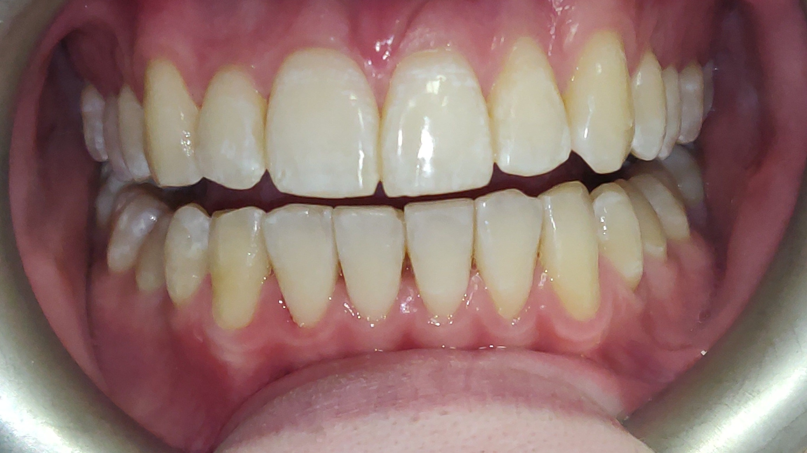 Slide 2