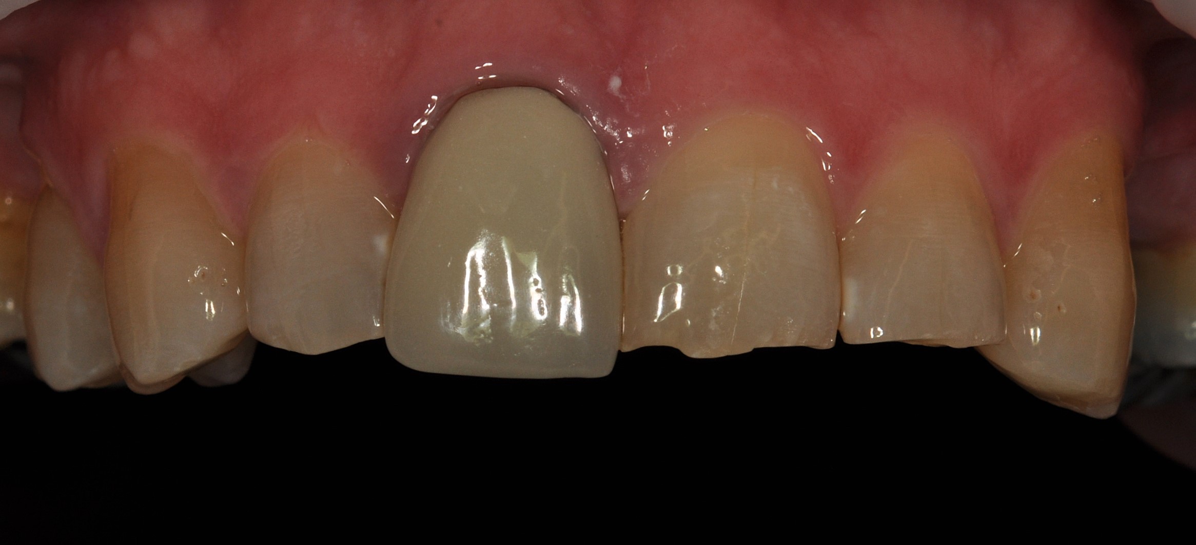 Slide 1