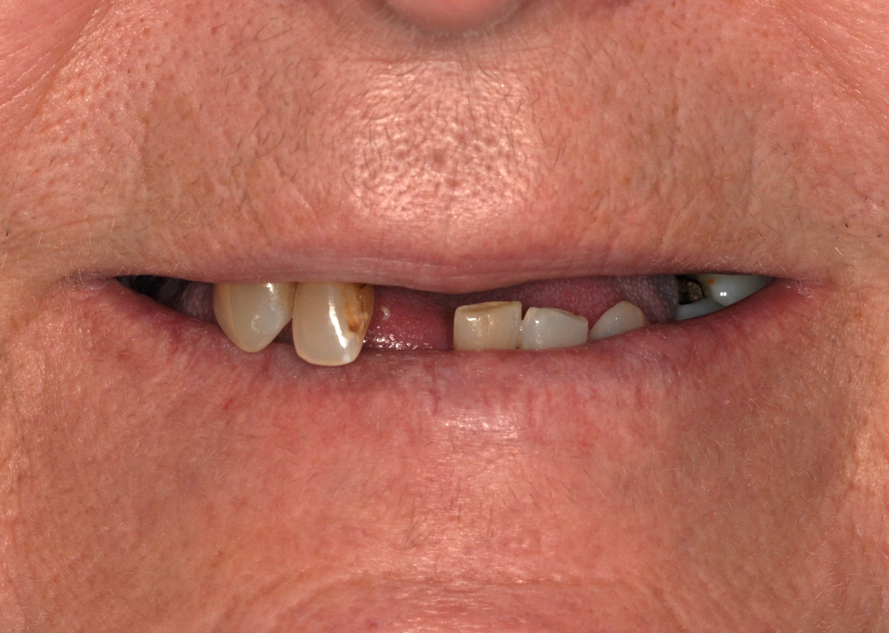 Slide 1