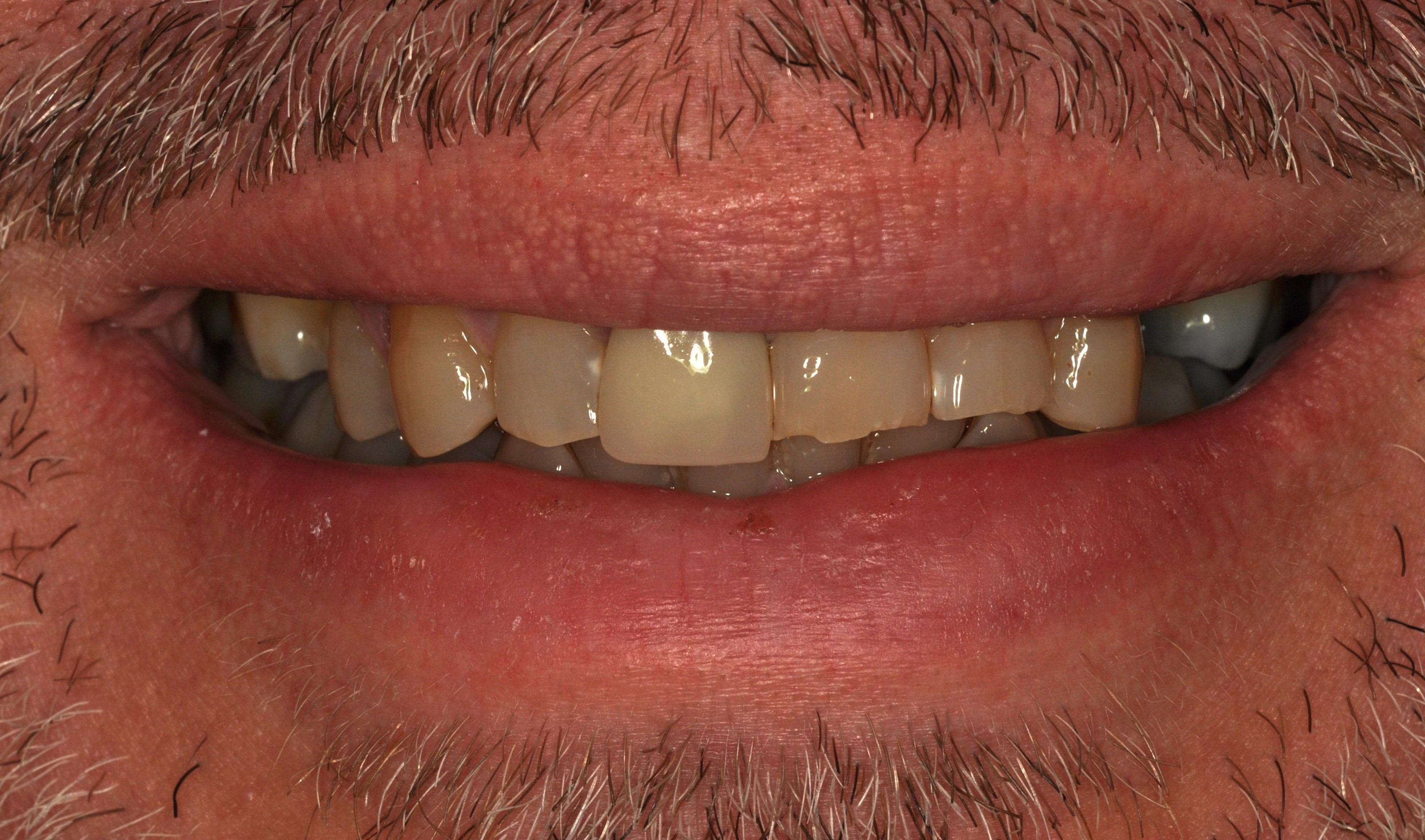 Slide 1