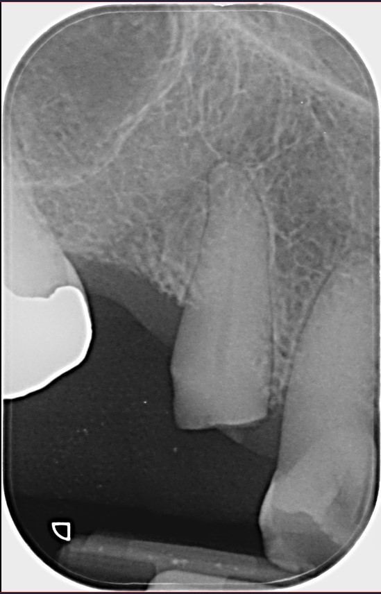 Slide 1